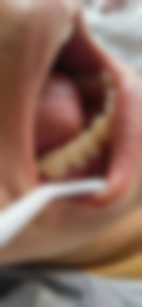 澳门看牙贵吗现在？2026新版价目表曝光种牙1880元起省70%珠海深圳边度平？