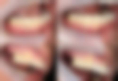 五、预约延伸:除了电话,还有哪些挂号方式?深圳市光明区人民医院预约挂号全攻略