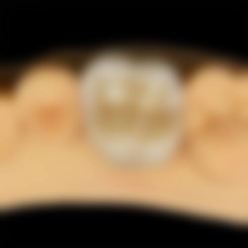 澳门看牙去哪个医院好？2026最新推荐珠海深圳跨境看牙省70%粤语问诊免翻译