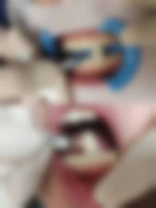 牙齿美白的功效