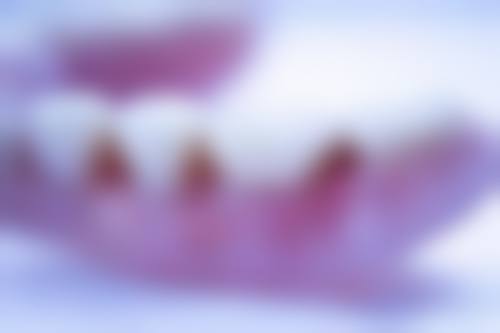 香港 澳门看牙贵吗现在 适合边类人群?三类姊妹更啱跨境睇牙