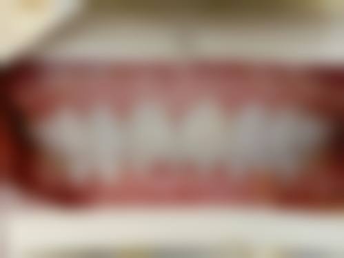 牙齿美白成效好吗