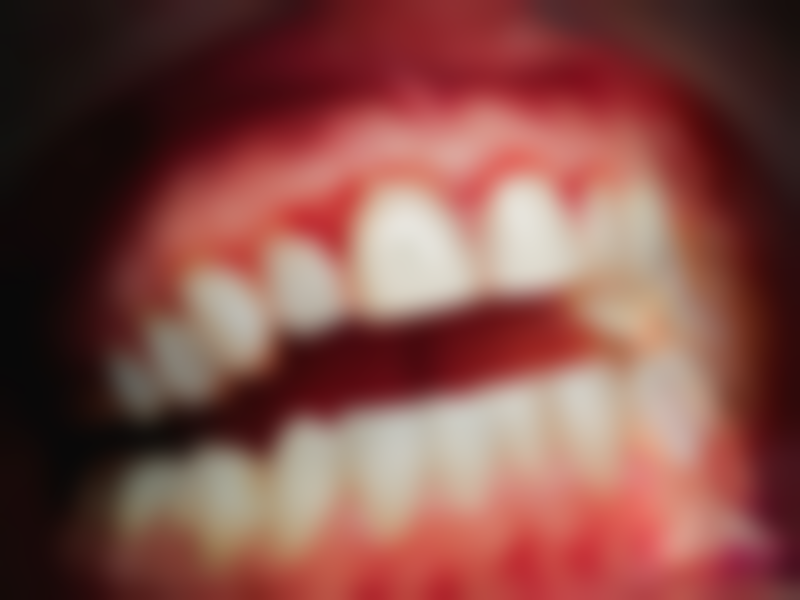 拓展延伸:賽馬會牙科服務真相+關鍵選擇點+避坑指南