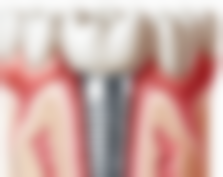 二、医院与科室实力揭秘：协和深圳医院口腔科到底怎么样？