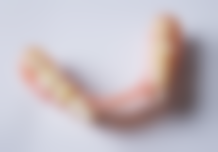 香港 格倫菲爾口腔討論區：收費貴唔貴？香港vs深圳價錢大比拼