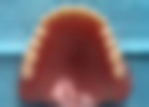 香港 澳门矫正牙齿的医院：术前术后避坑指南（结合香港生活习惯）