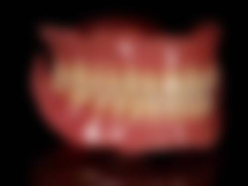 香港 香港大學深圳醫院牙科收費：避坑指南！呢啲細節要注意