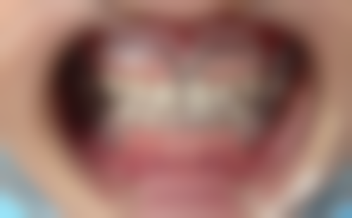 香港 澳门牙科十大排名 适合边类人群