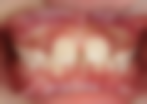 香港 麥芽口腔南山:點去更方便?口岸+地鐵路線大公開