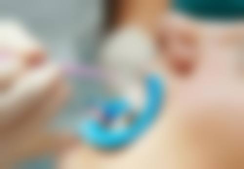 格倫菲爾口腔術前術後避坑指南(香港生活習慣版)