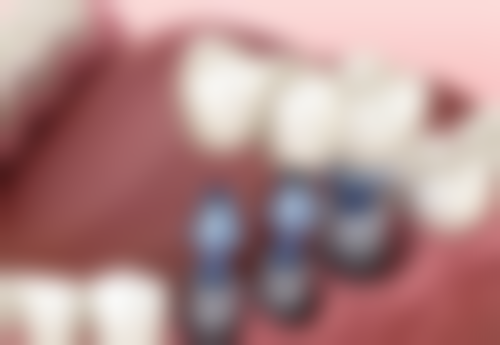 二、一个电话全搞定：详解0755 - 2158XXX的妙用