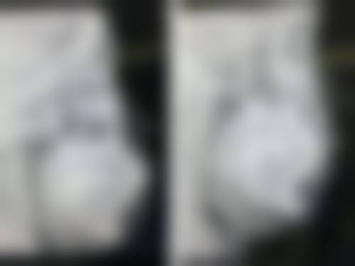 2026拱北通关10分钟：珠海牙科点样拣先至安心？