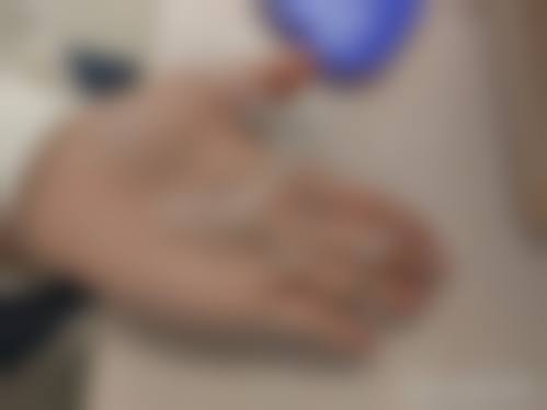 广州戴牙套比较好的医院收费参考:含广大口腔2026价目表