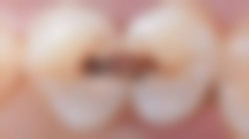 三、就诊前必读:协和深圳医院口腔科实力与地址大揭秘