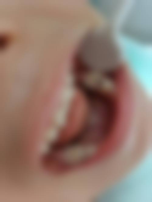 华中科技大学协和深圳医院口腔科预约挂号缴费流程，官网/公众号/电话0755-26553***都能搞定！