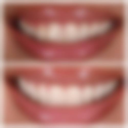 香港 在澳门看牙科贵不贵 适合边类人群？