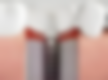 香港牙醫真實體驗:格倫菲爾口腔好唔好?