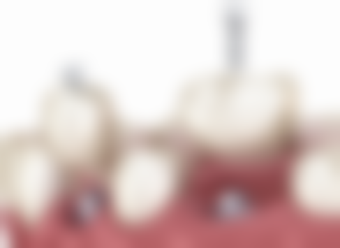 澳门矫正牙齿的医院边间好？2026排名+珠海通关10分钟粤语问诊箍牙价钱大公开