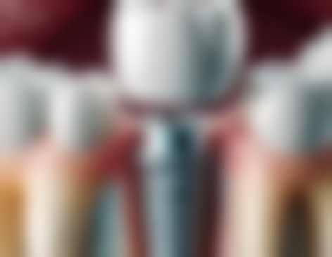 香港 格倫菲爾口腔 關鍵選擇點:安心、價錢、醫生點樣揀?