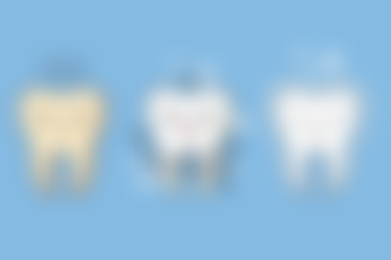 四、曹国栋医生的技术与典型操作流程