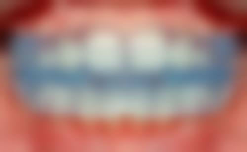 四、贵阳美莱医疗美容医院(口腔科)诊疗项目