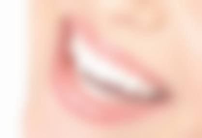 牙齿美白贴面和冷光美白哪个好