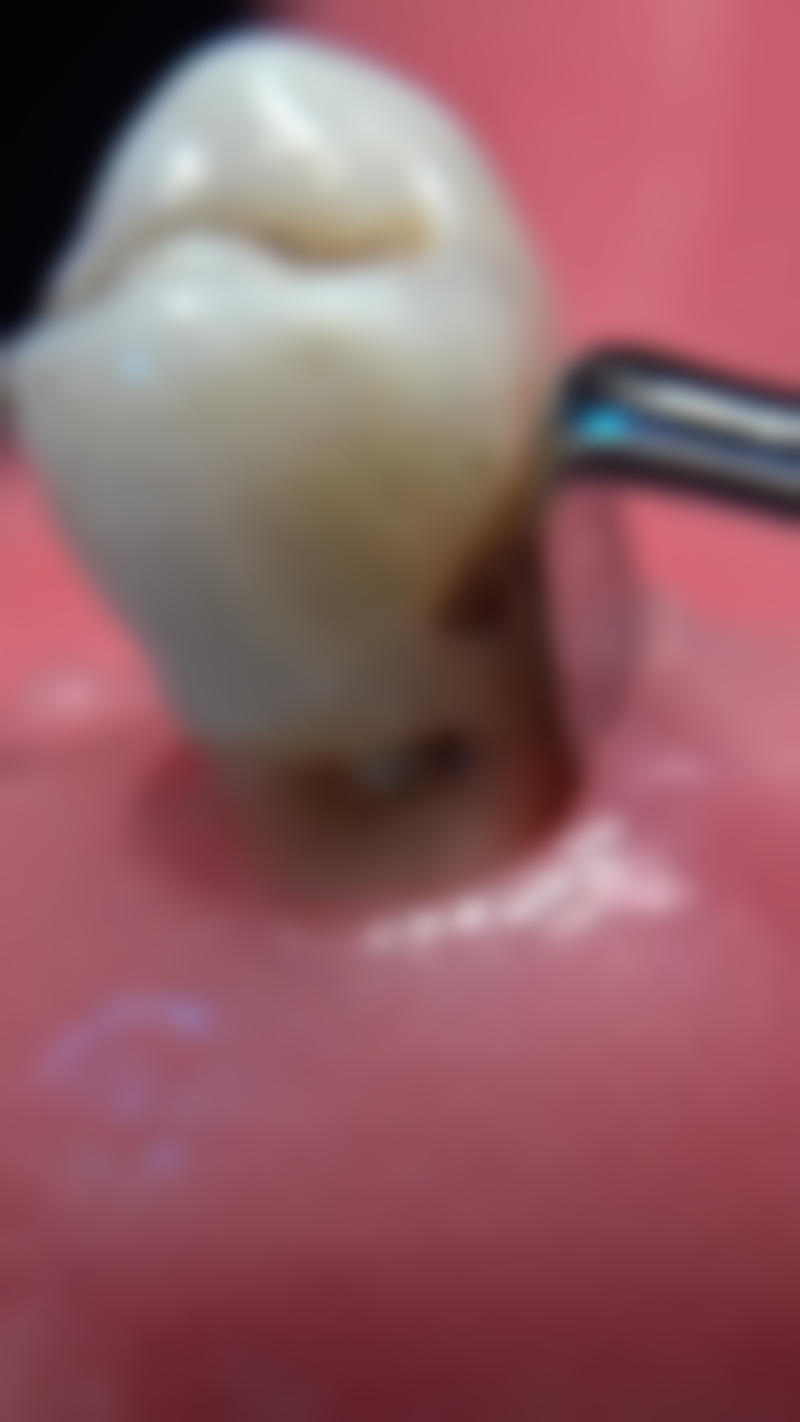 香港 深圳睇牙lihkg 适合边类人群？返工族/凑仔妈咪都啱晒