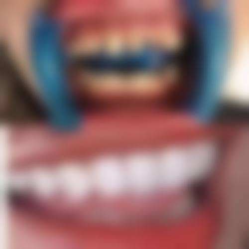 理性提醒：北上睇牙雖然平，但安心更重要！