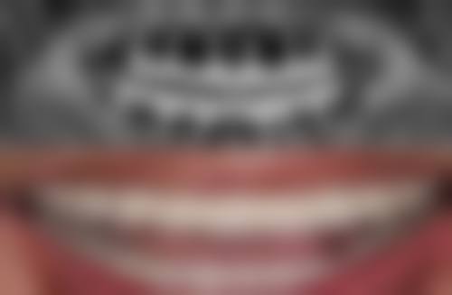 理性提醒：跨境睇牙，安心永远第一！