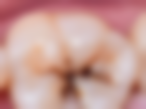 香港 澳门牙科医院排名前十 价钱范围（HKD）对比