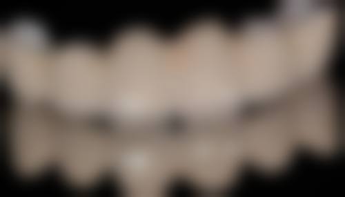 看醫牙自費多少錢？2026年香港牙科收費大公開！補牙/洗牙/拔牙一次幾多錢？