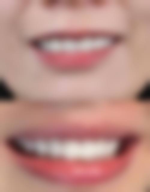 香港看醫牙自費貴嘅原因？3大因素影響收費