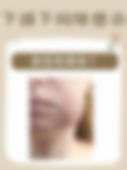 深圳口岸牙科收費對比：港人北上睇牙平幾多？