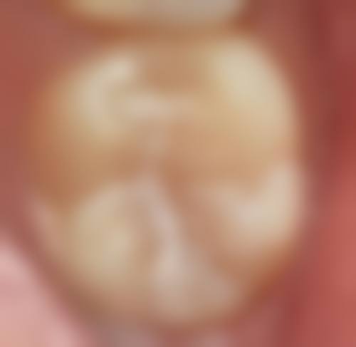 拓展延伸：牙科項目真相+關鍵選擇點+術前術後指南