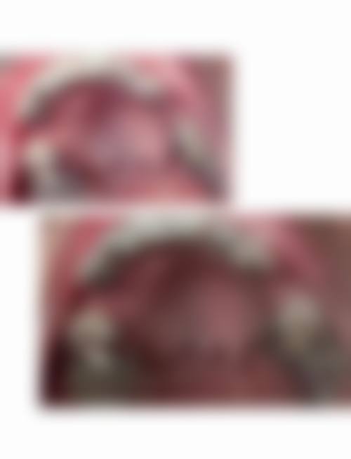 香港 澳门牙齿痛的药有哪些：止痛消炎必备4大类