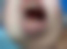 香港 澳门牙齿痛的药有哪些：买药渠道对比+避坑指南