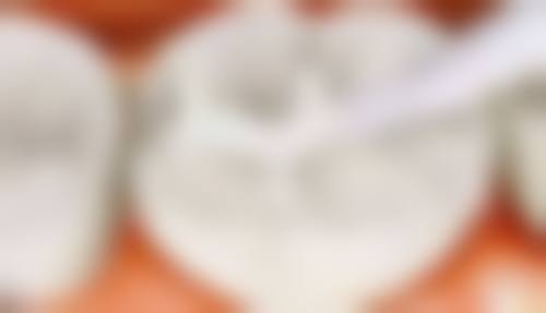 深圳補牙推薦2026：港人最愛10間診所！蓮塘/羅湖地鐵口，平3成價目表大公開