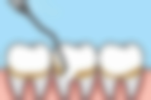 香港 麥芽口腔好唔好 邊間分店更方便港人？口岸直達+交通攻略