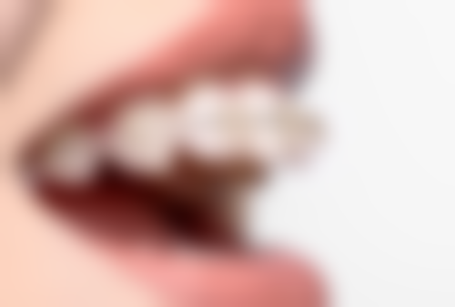 杭里口腔如何保护种植安心？正规资质+精良设备，从源头降低风险