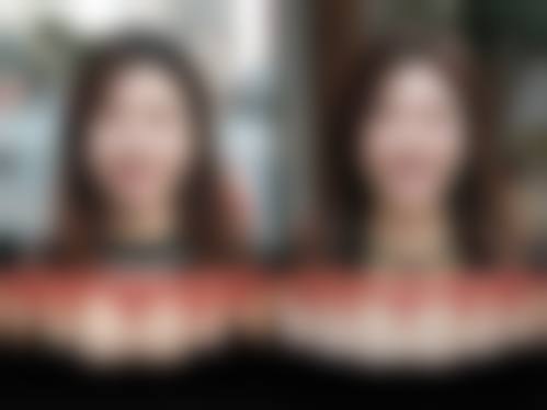 哪些人群在评估中更可能被建议考虑种植牙烤瓷牙？