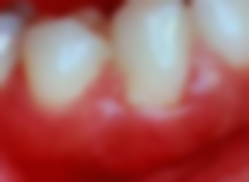 香港 麥芽口腔好唔好 技術實力點樣？設備+醫生團隊大公開