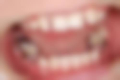 拓展延伸:深圳整牙常見問題解答