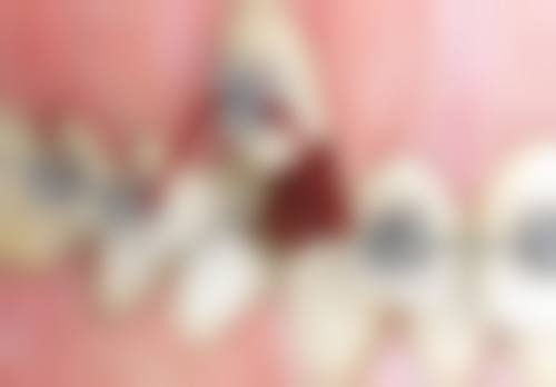 按矫正方案划分