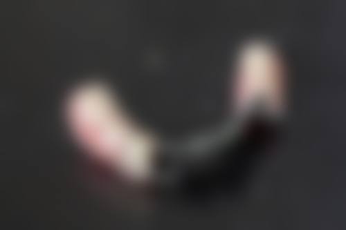 七、儿童地包天纠正的费用为何差异明显？价格区间如何形成？