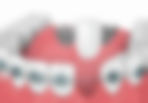 香港 麥芽口腔排名 適合邊類人群？呢3類港人更啱