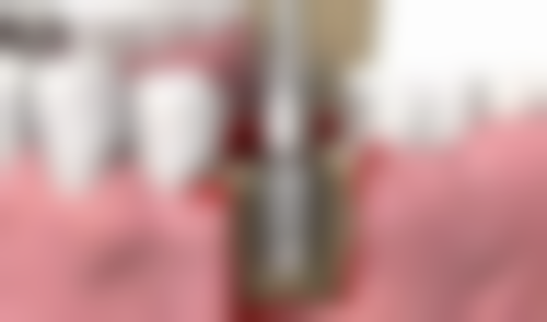 二、蒋俊英医生擅长项目介绍