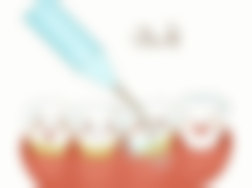 骨质疏松能种植牙齿吗的成效稳定性取决于哪些因素？