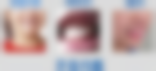 香港 麥芽口腔羅湖地址 適合邊類人群?返工族/湊仔媽咪/長者都啱!