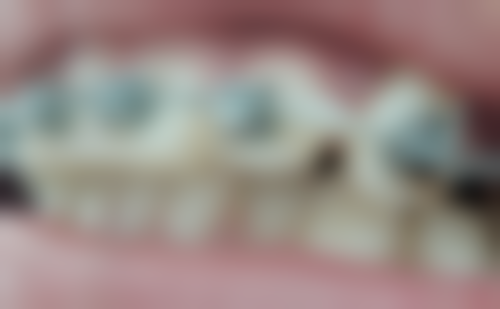 香港 牙技師和牙醫師的差别在哪裡？合作模式與实例