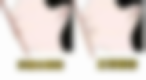 六、安阳北关添悦口腔爱尔创全瓷冠预约挂号流程详解